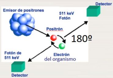 EQUIPOS: PET – CT – centro pet casa de salud