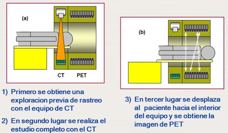 EQUIPOS: PET – CT – centro pet casa de salud