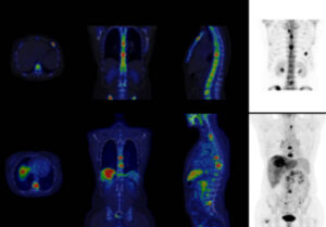 EQUIPOS: PET – SPECT – CT – Centro Pet Salud